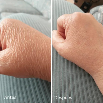 Mokio – Novaderm Crema Reparadora Corporal