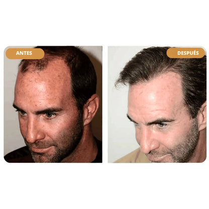 Hairzen Hair Root Shampoo